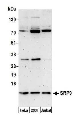 Western Blot: SRP9 Antibody [NBP2-61107]