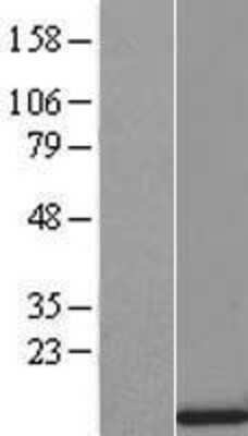 Western Blot: SRP9 Overexpression Lysate [NBL1-16454]