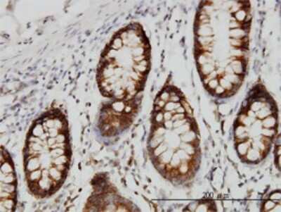 Immunohistochemistry-Paraffin: SRPK1 Antibody (6H5) [H00006732-M01]