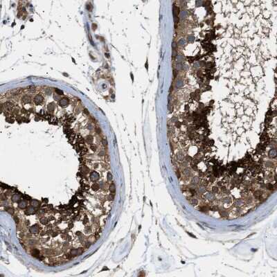 Immunohistochemistry-Paraffin: SRPK1 Antibody [NBP1-87050]