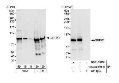 Western Blot: SRPK1 Antibody [NBP1-30108]