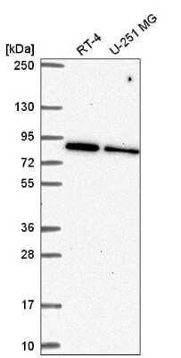 Western Blot: SRPK1 Antibody [NBP2-58538]