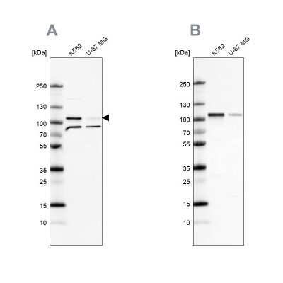 Western Blot: SRPK1 Antibody [NBP2-58538]