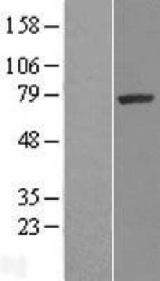 Western Blot: SRPK1 Overexpression Lysate [NBL1-16455]