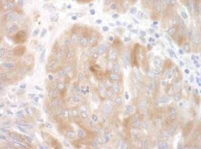 Immunohistochemistry: SRPK2 Antibody [NBP1-30114]