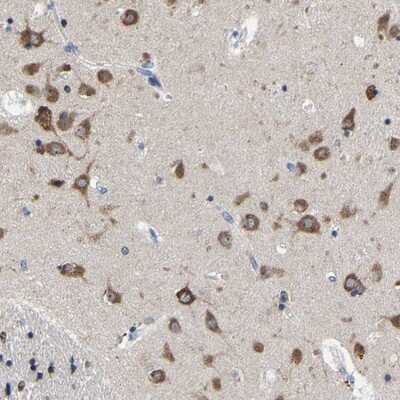 Immunohistochemistry-Paraffin: SRPK2 Antibody [NBP1-87048]