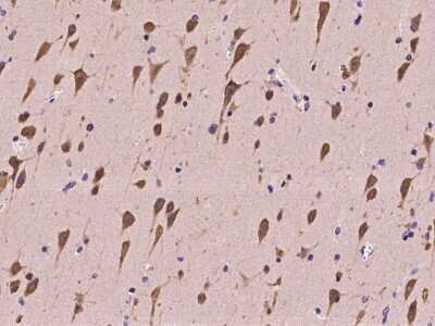 Immunohistochemistry-Paraffin: SRPK2 Antibody [NBP2-97313]