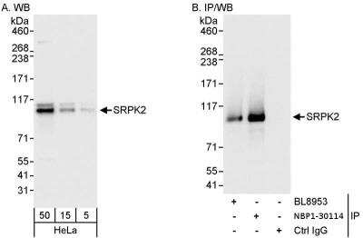Immunoprecipitation: SRPK2 Antibody [NBP1-30114]