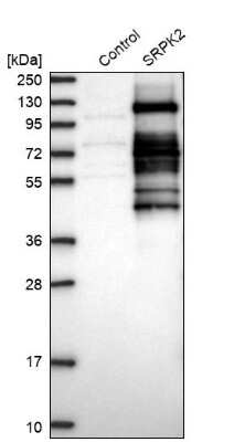 Western Blot: SRPK2 Antibody [NBP1-87048]