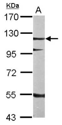 Western Blot: SRPK2 Antibody [NBP2-20484]