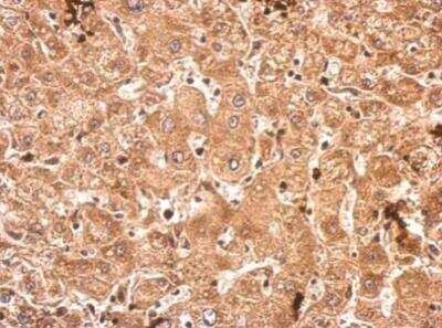 Immunohistochemistry-Paraffin: SRPK3/STK23 Antibody [NBP2-20515]