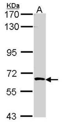 Western Blot: SRPK3/STK23 Antibody [NBP2-20515]