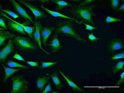 Immunocytochemistry/ Immunofluorescence: SRPR alpha Antibody [H00006734-B02P]