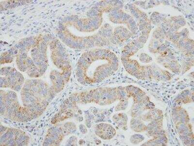 Immunohistochemistry-Paraffin: SRPR alpha Antibody [NBP1-32421]