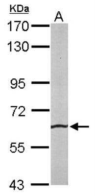 Western Blot: SRPR alpha Antibody [NBP1-32421]