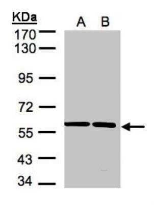 Western Blot: SRPR alpha Antibody [NBP1-32421]