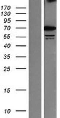 Western Blot: SRPR alpha Overexpression Lysate [NBP2-10872]