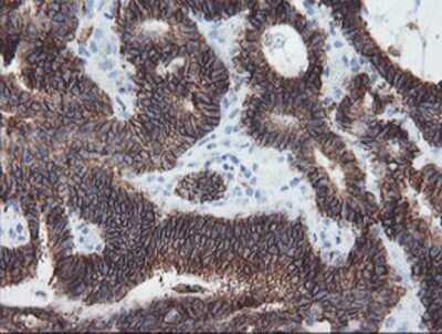 Immunohistochemistry-Paraffin: SRPRB Antibody (OTI1D9) [NBP2-02028]
