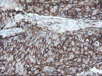 Immunohistochemistry-Paraffin: SRPRB Antibody (OTI1D9) [NBP2-02028]