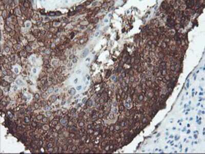 Immunohistochemistry-Paraffin: SRPRB Antibody (OTI1D9) [NBP2-02028]