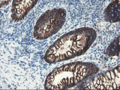 Immunohistochemistry-Paraffin: SRPRB Antibody (OTI1D9) [NBP2-02028]
