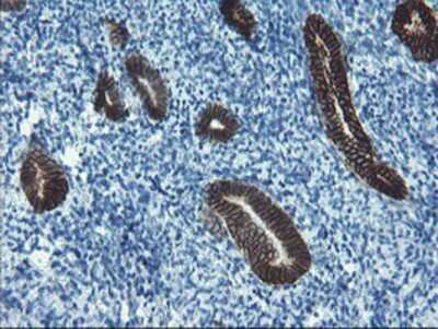 Immunohistochemistry-Paraffin: SRPRB Antibody (OTI1D9) [NBP2-02028]