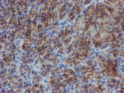 Immunohistochemistry-Paraffin: SRPRB Antibody (OTI1D9) [NBP2-02028]