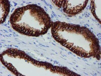Immunohistochemistry-Paraffin: SRPRB Antibody (OTI1D9) [NBP2-02028]