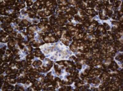 Immunohistochemistry: SRPRB Antibody (OTI2D4) [NBP2-45958]