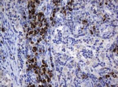 Immunohistochemistry: SRPRB Antibody (OTI2D4) [NBP2-45958]