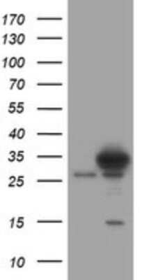 Western Blot: SRPRB Antibody (OTI2D4) [NBP2-45958]