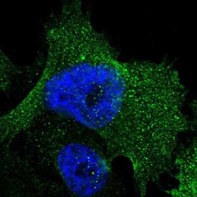 Immunocytochemistry/ Immunofluorescence: SRPRB Antibody [NBP1-89035]