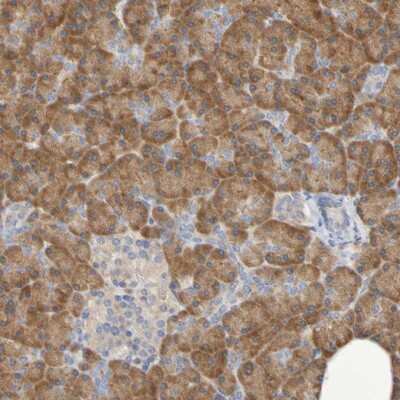 Immunohistochemistry-Paraffin: SRPRB Antibody [NBP1-89035]