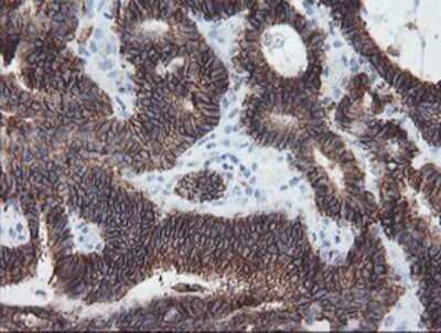 Immunohistochemistry: SRPRB Antibody (OTI1D9) - Azide and BSA Free [NBP2-74350]