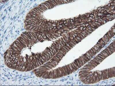 Immunohistochemistry: SRPRB Antibody (OTI1D9) - Azide and BSA Free [NBP2-74350]