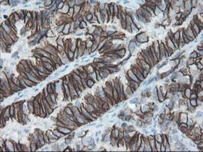Immunohistochemistry: SRPRB Antibody (OTI1D9) - Azide and BSA Free [NBP2-74350]