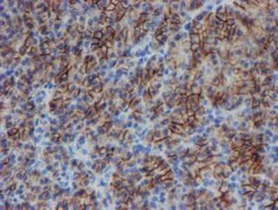 Immunohistochemistry: SRPRB Antibody (OTI1D9) - Azide and BSA Free [NBP2-74350]