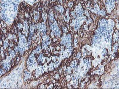 Immunohistochemistry: SRPRB Antibody (OTI1D9) - Azide and BSA Free [NBP2-74350]
