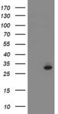 Western Blot: SRPRB Antibody (OTI1D9)Azide and BSA Free [NBP2-74350]