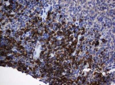 Immunohistochemistry: SRPRB Antibody (OTI2D4) - Azide and BSA Free [NBP2-74351]