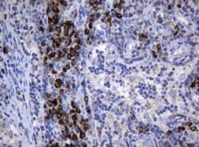 Immunohistochemistry: SRPRB Antibody (OTI2D4) - Azide and BSA Free [NBP2-74351]