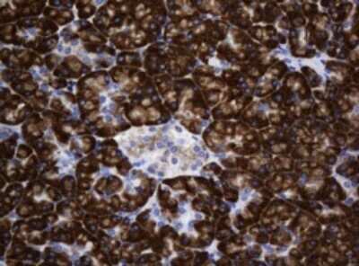 Immunohistochemistry: SRPRB Antibody (OTI2D4) - Azide and BSA Free [NBP2-74351]