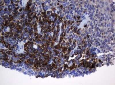 Immunohistochemistry: SRPRB Antibody (OTI2D4) - Azide and BSA Free [NBP2-74351]