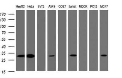Western Blot: SRPRB Antibody (OTI2D4)Azide and BSA Free [NBP2-74351]