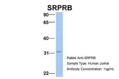 Western Blot: SRPRB Antibody [NBP1-59710]