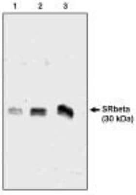 Western Blot: SRPRB Antibody [NBP2-66584]