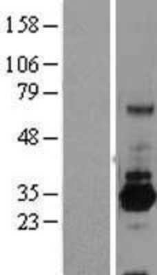 Western Blot: SRPRB Overexpression Lysate [NBL1-16457]