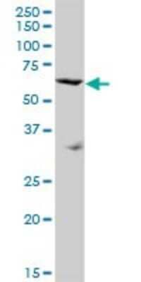 Western Blot: SRPX Antibody [H00008406-B01P]