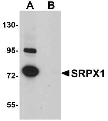 Western Blot: SRPX AntibodyBSA Free [NBP1-77086]