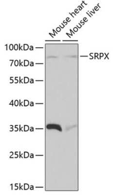 Western Blot: SRPX AntibodyBSA Free [NBP2-93855]